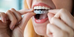 Woman putting on clear aligners – Invisalign vs. braces comparison.