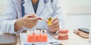 Dentist explaining tooth damage with model – Cracked or Chipped Tooth.