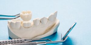 Dental crowns on a tooth model with dental tools.